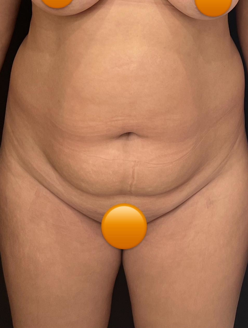 Foto da paciente antes do procedimento