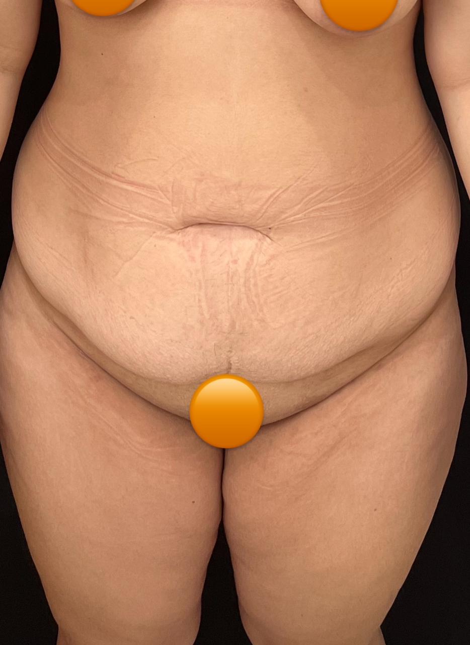 Foto da paciente antes do procedimento