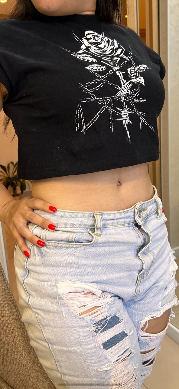 Foto da paciente posterior ao procedimento.